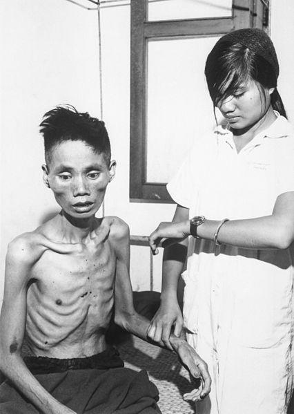 Released Prisoner After One Month in Viet Cong Prison Camp, South Vietnam, 1966