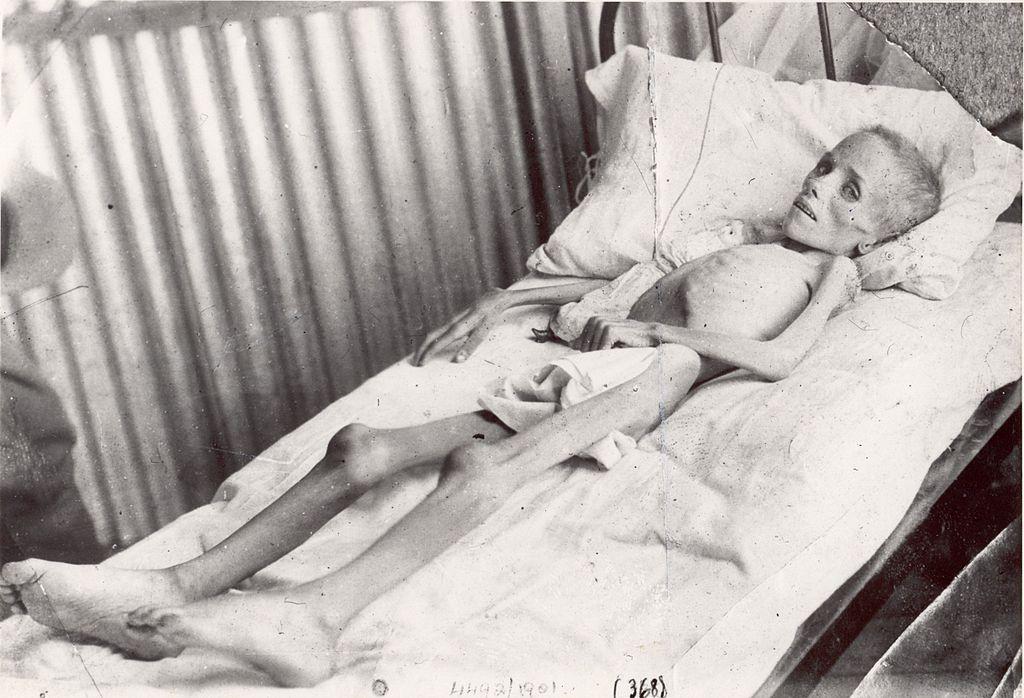 Starving Boer Child