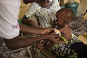 Measuring the mid-upper arm circumference, another malnutrition and access to food indicator.